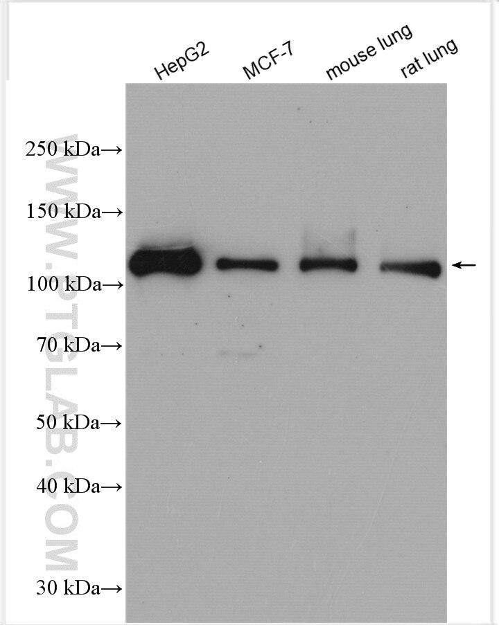 Western Blot (WB) analysis of various lysates using SH3BP4 Polyclonal antibody (29623-1-AP)