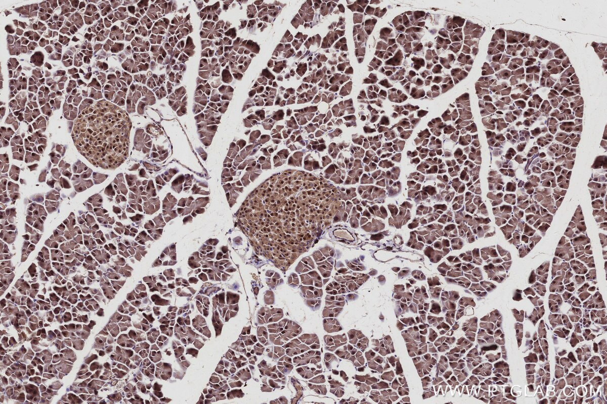 IHC staining of mouse pancreas using 68045-1-Ig Immunohistochemistry (IHC) staining of mouse pancreas tissue using SH3BP4 Monoclonal antibody (68045-1-Ig)