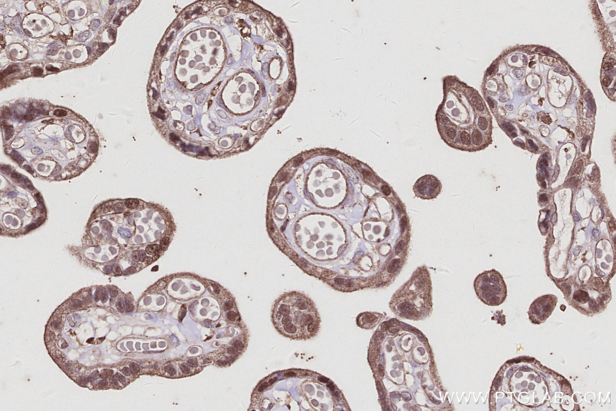 IHC staining of human placenta using 68045-1-Ig Immunohistochemistry (IHC) staining of human placenta tissue using SH3BP4 Monoclonal antibody (68045-1-Ig)