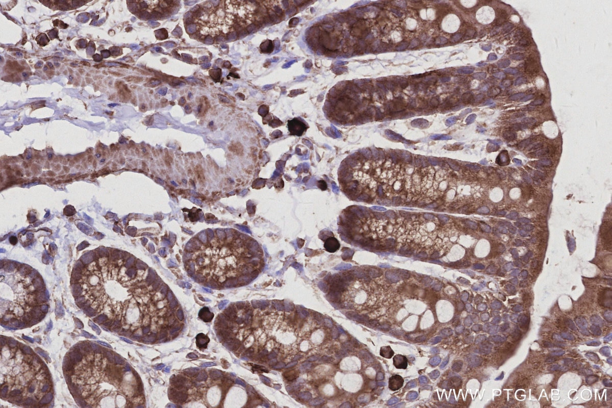IHC staining of mouse colon using 68045-1-Ig Immunohistochemistry (IHC) staining of mouse colon tissue using SH3BP4 Monoclonal antibody (68045-1-Ig)