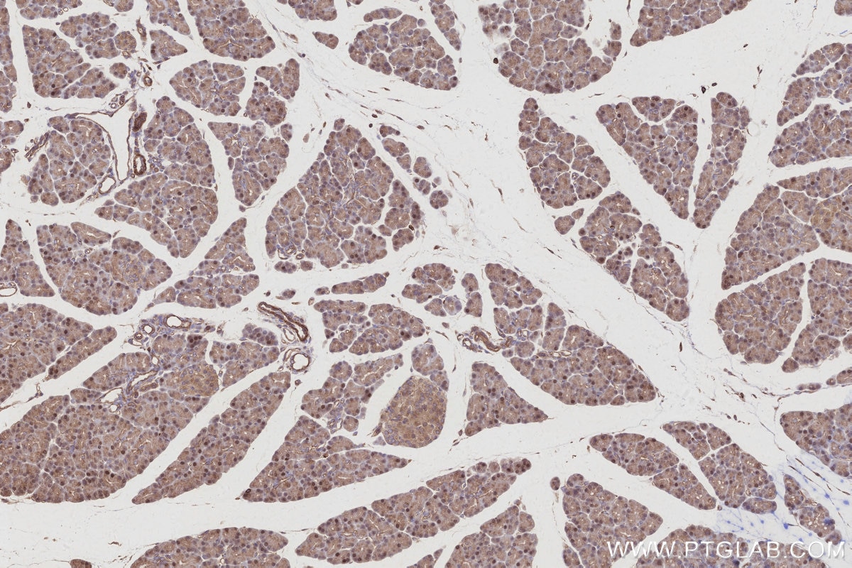 IHC staining of rat pancreas using 68045-1-Ig Immunohistochemistry (IHC) staining of rat pancreas tissue using SH3BP4 Monoclonal antibody (68045-1-Ig)