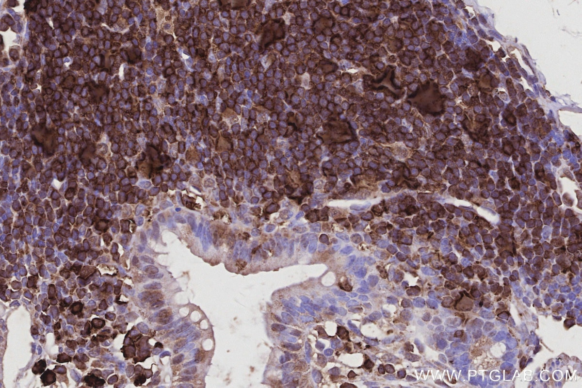 IHC staining of mouse colon using 68045-1-Ig Immunohistochemistry (IHC) staining of mouse colon tissue using SH3BP4 Monoclonal antibody (68045-1-Ig)
