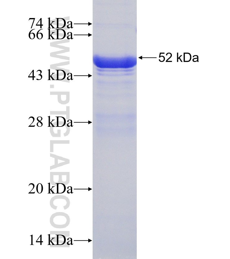 SH3BP4 fusion protein Ag31221 SDS-PAGE