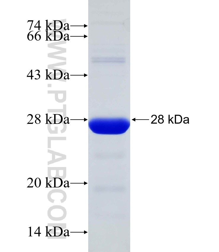 SH3BP4 fusion protein Ag31238 SDS-PAGE