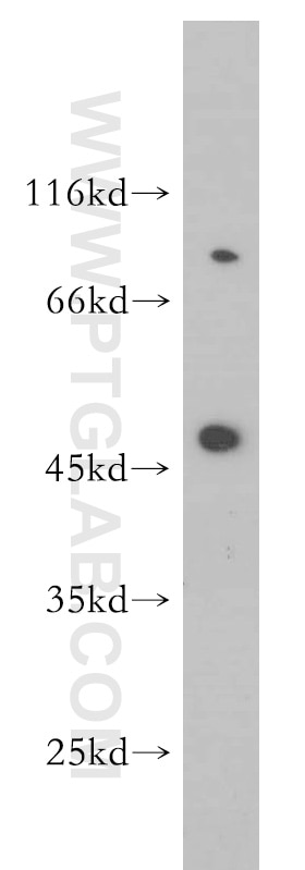 Western Blot (WB) analysis of Raji cells using SH3BP5 Polyclonal antibody (11127-2-AP)