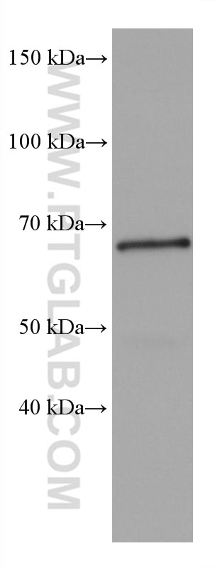 Western Blot (WB) analysis of mouse brain tissue using SH3BP5 Monoclonal antibody (67841-1-Ig)