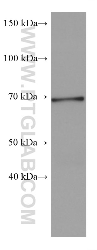 Western Blot (WB) analysis of rabbit brain tissue using SH3BP5 Monoclonal antibody (67841-1-Ig)