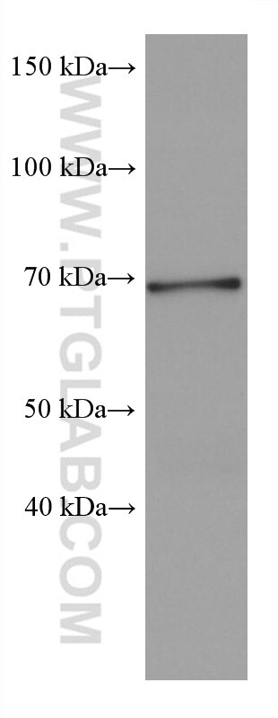 WB analysis of rabbit brain using 67841-1-Ig