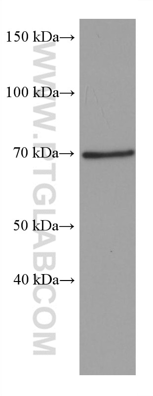 Western Blot (WB) analysis of chicken brain tissue using SH3BP5 Monoclonal antibody (67841-1-Ig)