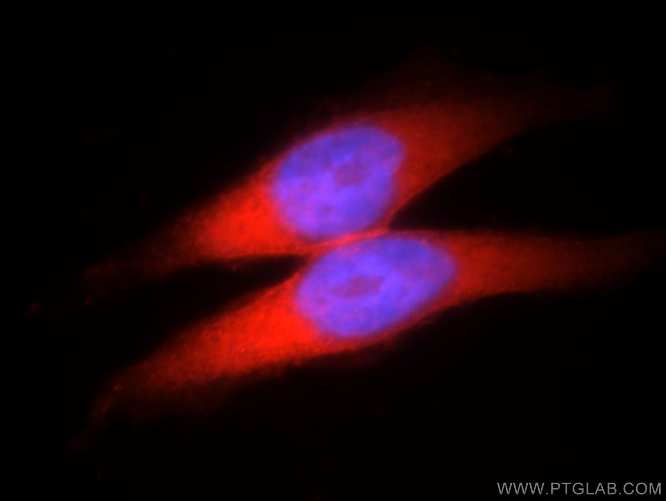 Immunofluorescence (IF) / fluorescent staining of HeLa cells using SH3D19 Polyclonal antibody (21499-1-AP)