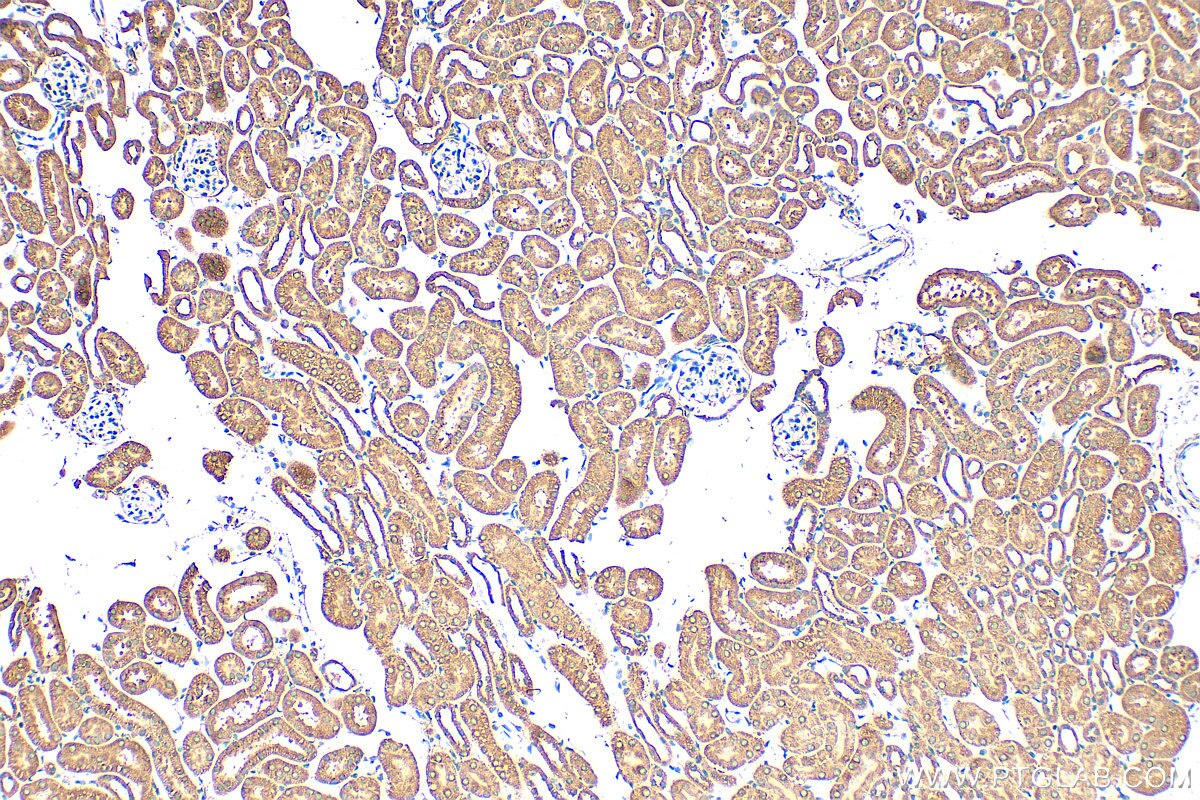 Immunohistochemistry (IHC) staining of mouse kidney tissue using SH3D19 Polyclonal antibody (21499-1-AP)
