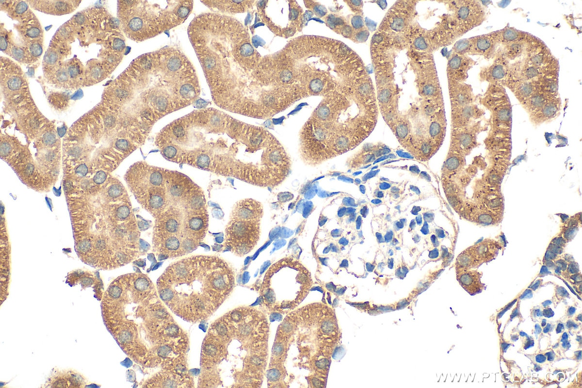 Immunohistochemistry (IHC) staining of mouse kidney tissue using SH3D19 Polyclonal antibody (21499-1-AP)