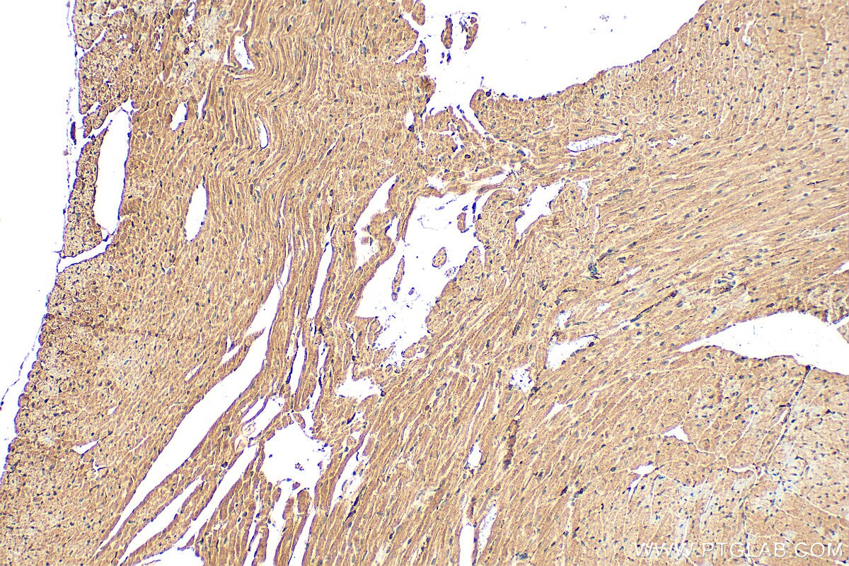 Immunohistochemistry (IHC) staining of mouse heart tissue using SH3D19 Polyclonal antibody (21499-1-AP)