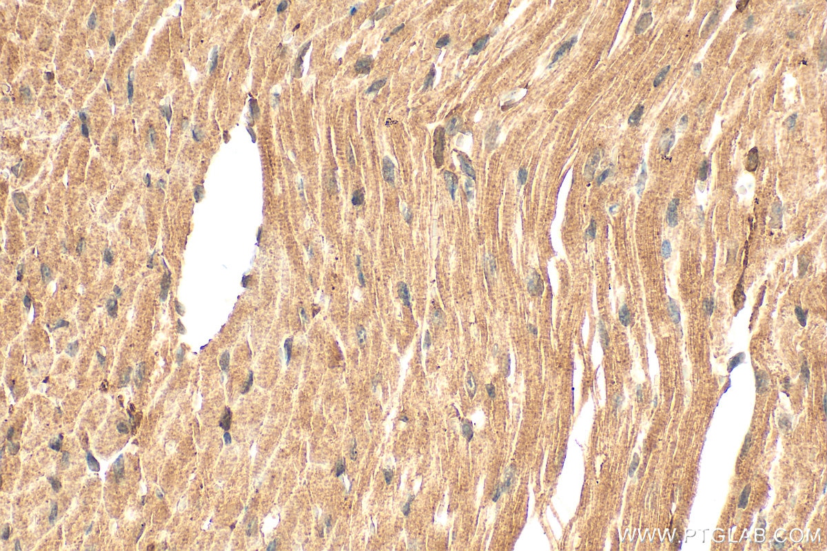 Immunohistochemistry (IHC) staining of mouse heart tissue using SH3D19 Polyclonal antibody (21499-1-AP)
