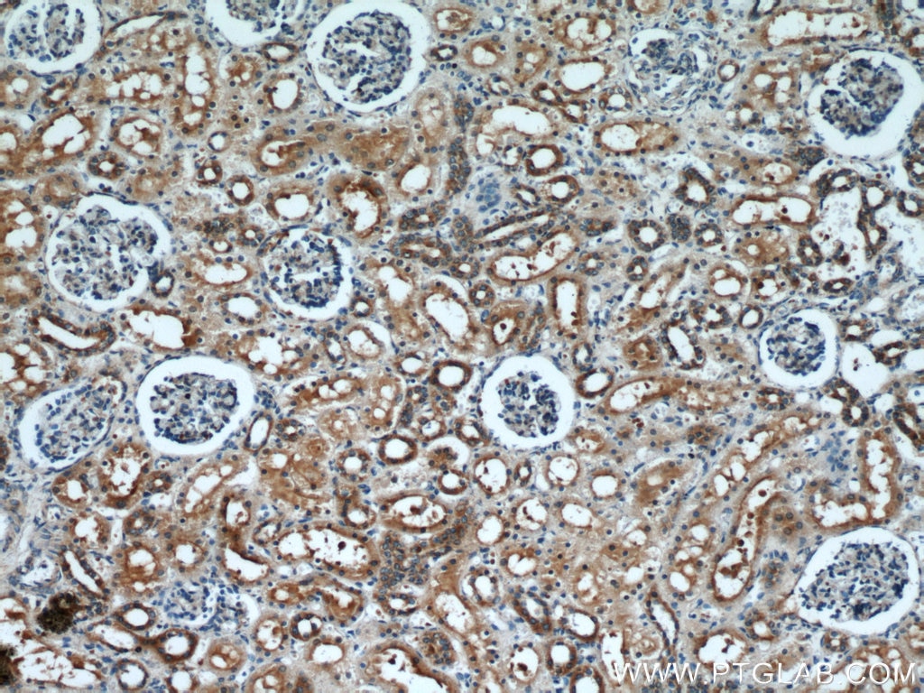 Immunohistochemistry (IHC) staining of human kidney tissue using SH3D19 Polyclonal antibody (21499-1-AP)