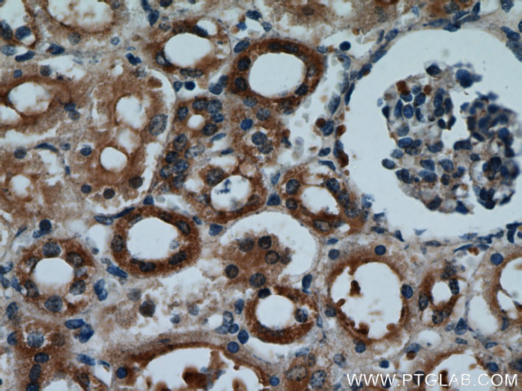 Immunohistochemistry (IHC) staining of human kidney tissue using SH3D19 Polyclonal antibody (21499-1-AP)
