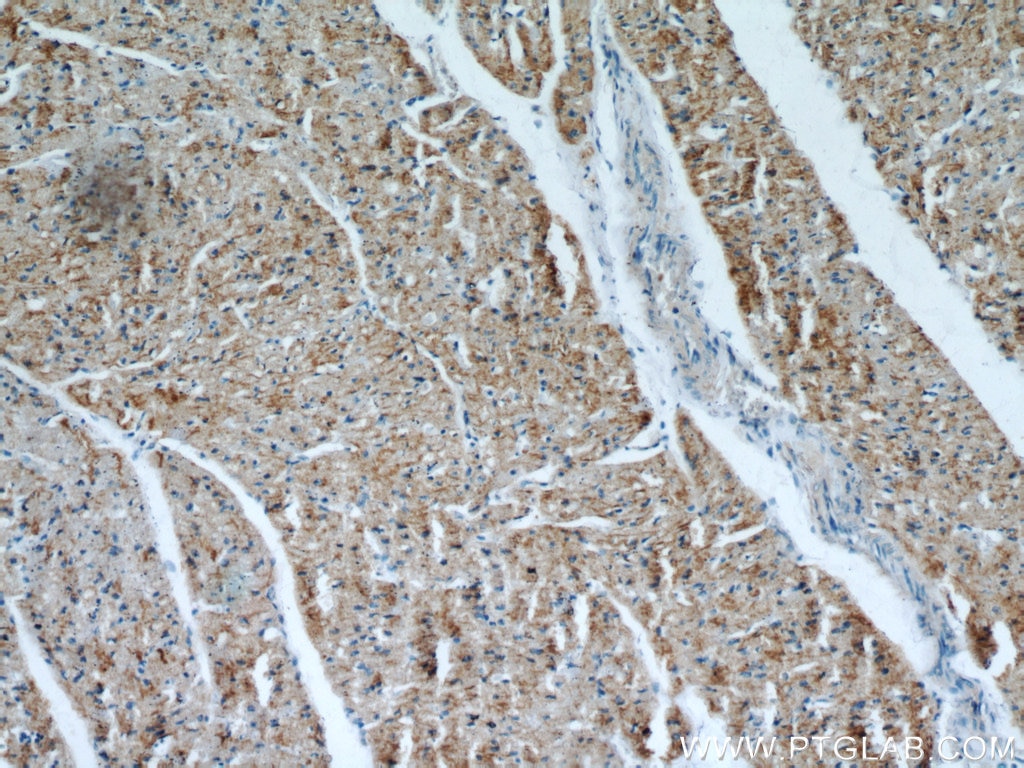 Immunohistochemistry (IHC) staining of human heart tissue using SH3D19 Polyclonal antibody (21499-1-AP)