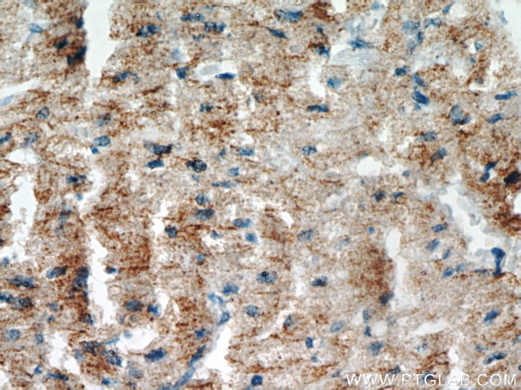 Immunohistochemistry (IHC) staining of human heart tissue using SH3D19 Polyclonal antibody (21499-1-AP)