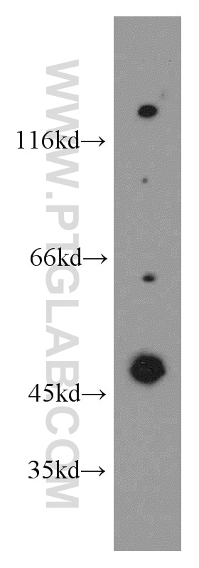 Western Blot (WB) analysis of HT-1080 cells using SH3D19 Polyclonal antibody (21499-1-AP)