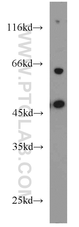 Western Blot (WB) analysis of Y79 cells using SH3D19 Polyclonal antibody (21499-1-AP)
