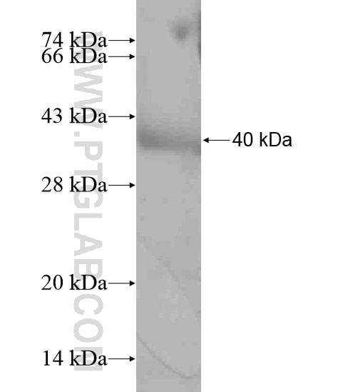 SH3D20 fusion protein Ag19405 SDS-PAGE