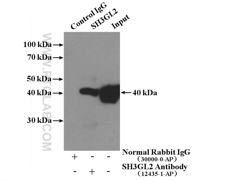 Immunoprecipitation (IP) experiment of mouse brain tissue using Endophilin 1 Polyclonal antibody (12435-1-AP)