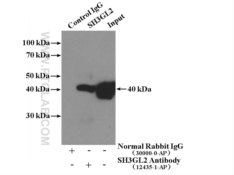 IP experiment of mouse brain using 12435-1-AP