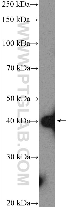 SH3GL2 Polyclonal antibody