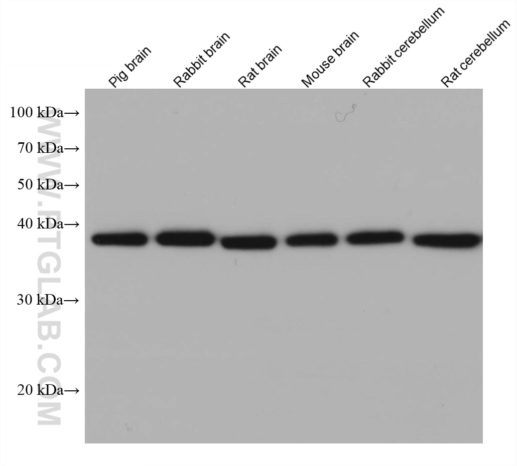 Western Blot (WB) analysis of various lysates using Endophilin 1 Monoclonal antibody (68029-1-Ig)