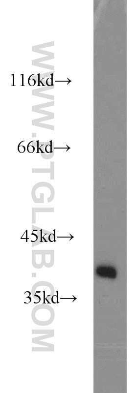 Western Blot (WB) analysis of human brain tissue using SH3GL3 Polyclonal antibody (13849-1-AP)