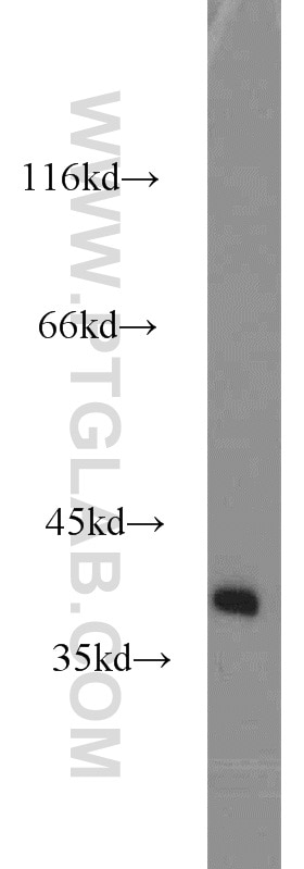 WB analysis of human brain using 13849-1-AP