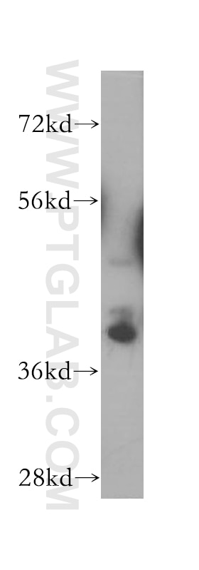 Western Blot (WB) analysis of human brain tissue using SH3GL3 Polyclonal antibody (13849-1-AP)