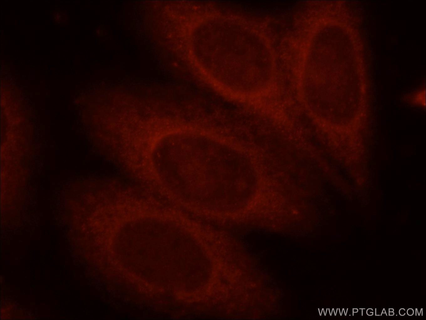 Immunofluorescence (IF) / fluorescent staining of HepG2 cells using Bif-1 Polyclonal antibody (15422-1-AP)