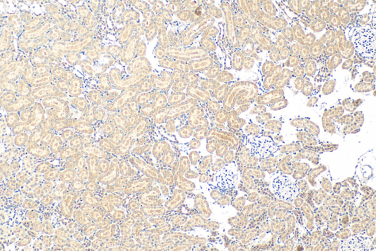 Immunohistochemistry (IHC) staining of rat kidney tissue using Bif-1 Polyclonal antibody (15422-1-AP)