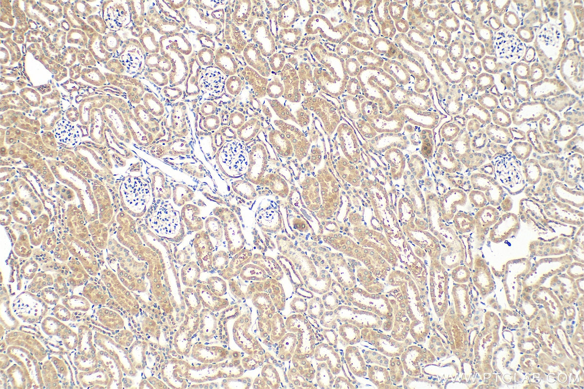 Immunohistochemistry (IHC) staining of mouse kidney tissue using Bif-1 Polyclonal antibody (15422-1-AP)