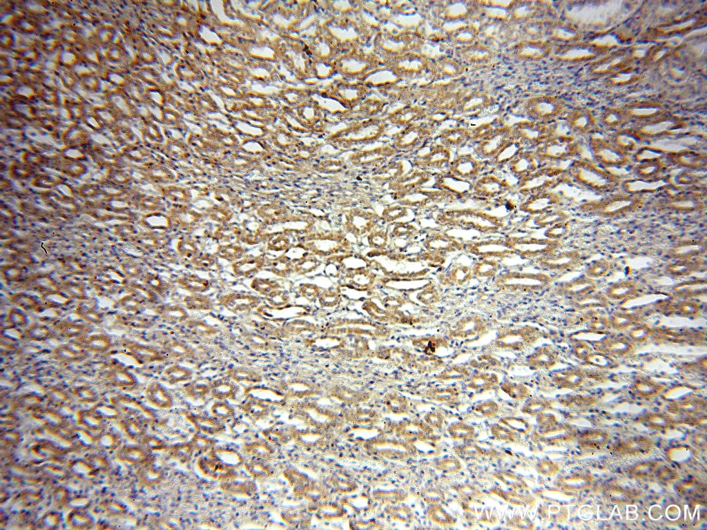 Immunohistochemistry (IHC) staining of human kidney tissue using Bif-1 Polyclonal antibody (15422-1-AP)