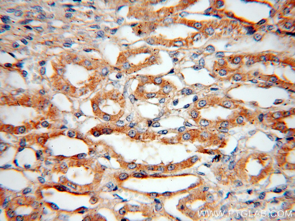 Immunohistochemistry (IHC) staining of human kidney tissue using Bif-1 Polyclonal antibody (15422-1-AP)