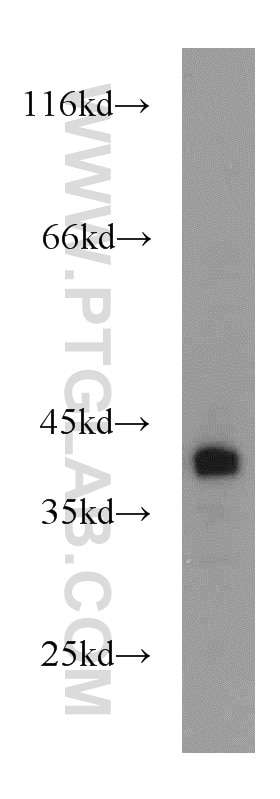 Western Blot (WB) analysis of mouse kidney tissue using Bif-1 Polyclonal antibody (15422-1-AP)
