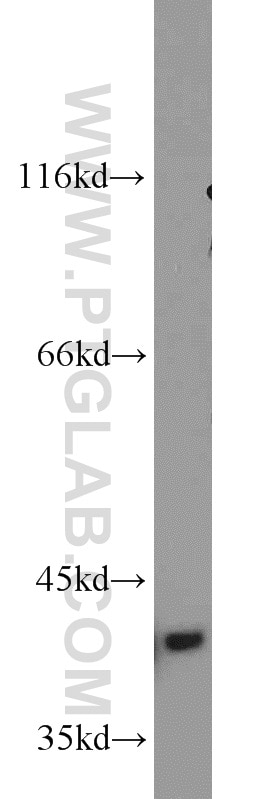 Western Blot (WB) analysis of mouse heart tissue using Bif-1 Polyclonal antibody (15422-1-AP)