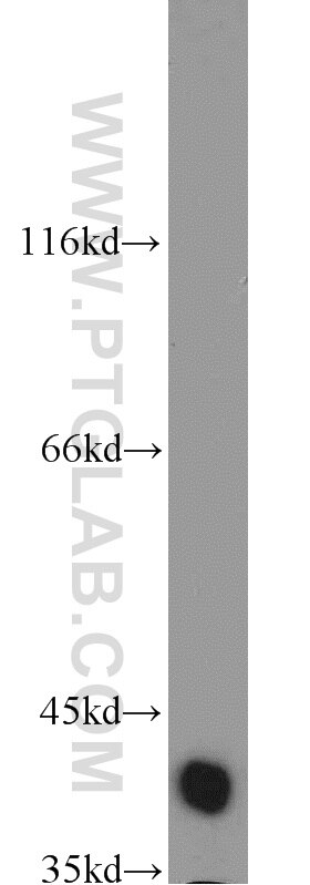 Western Blot (WB) analysis of mouse placenta tissue using Bif-1 Polyclonal antibody (15422-1-AP)