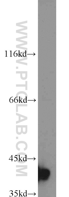 Western Blot (WB) analysis of mouse placenta tissue using Bif-1 Polyclonal antibody (15422-1-AP)