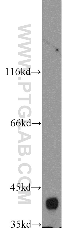 WB analysis of mouse kidney using 15422-1-AP