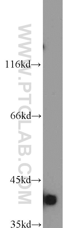 Western Blot (WB) analysis of mouse kidney tissue using Bif-1 Polyclonal antibody (15422-1-AP)