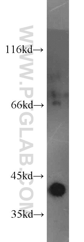 Western Blot (WB) analysis of mouse heart tissue using Bif-1 Polyclonal antibody (15422-1-AP)