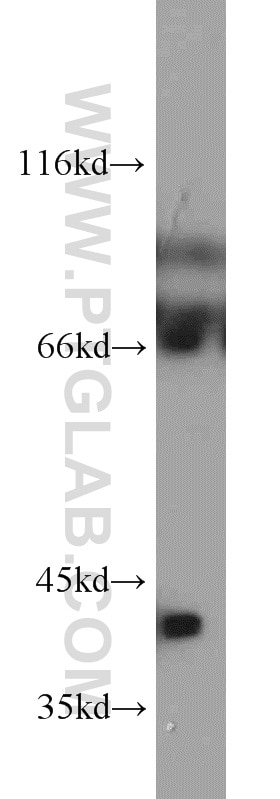 Western Blot (WB) analysis of mouse heart tissue using Bif-1 Polyclonal antibody (15422-1-AP)