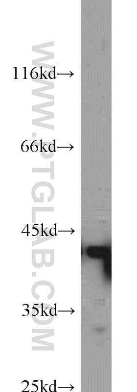 Western Blot (WB) analysis of HEK-293 cells using Bif-1 Polyclonal antibody (15422-1-AP)