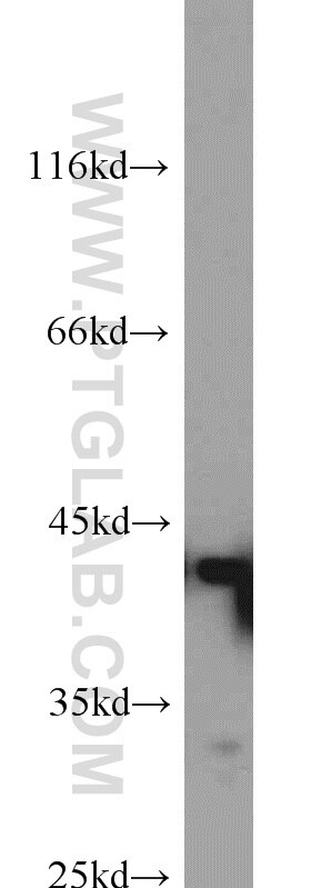 WB analysis of HEK-293 using 15422-1-AP