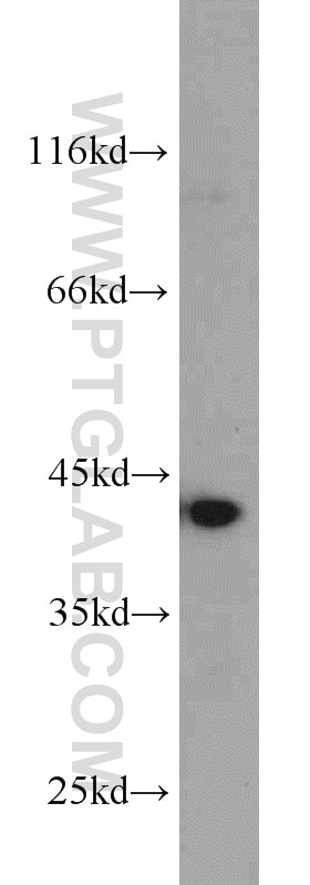 Western Blot (WB) analysis of human placenta tissue using Bif-1 Polyclonal antibody (15422-1-AP)