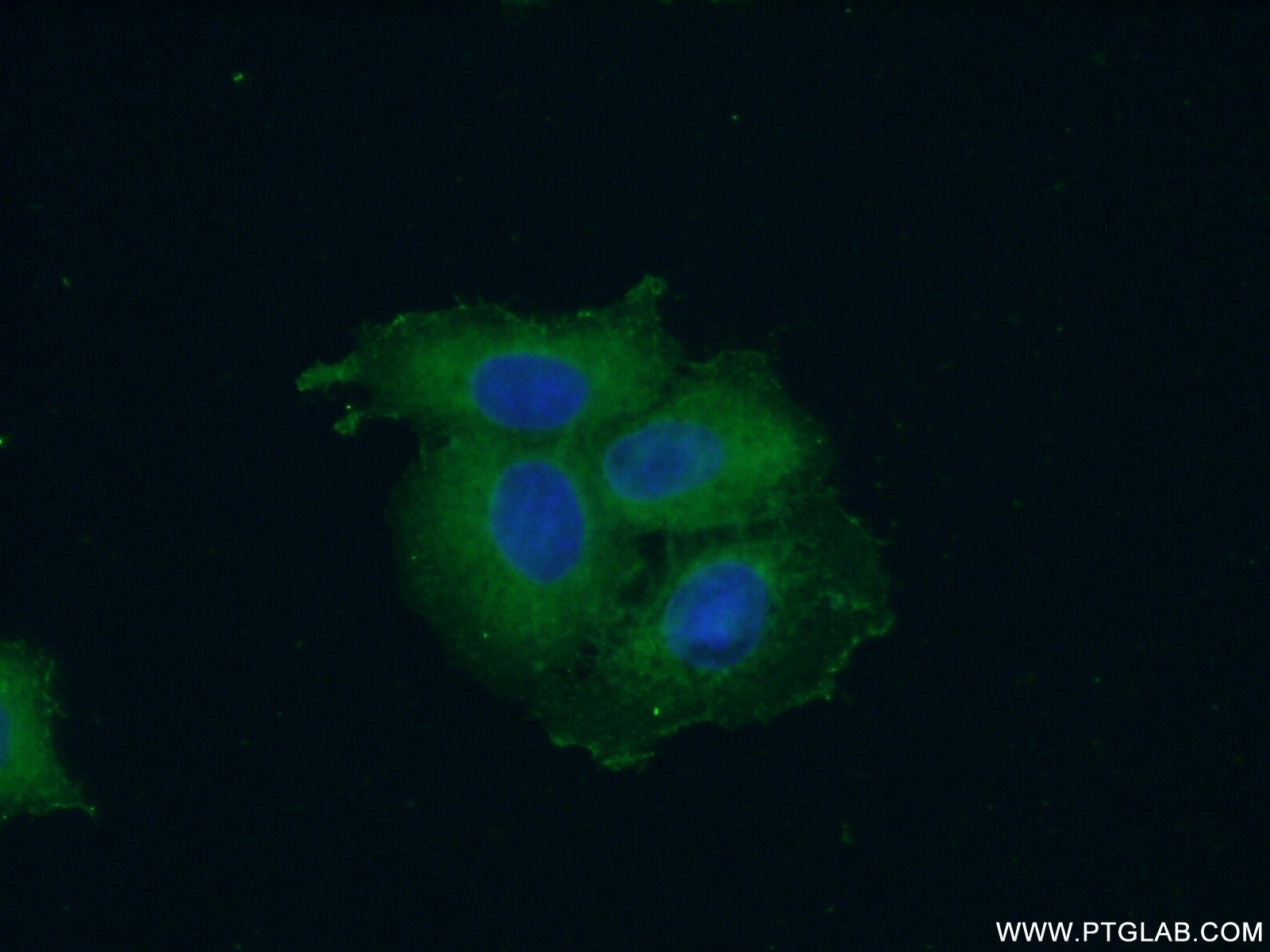 Immunofluorescence (IF) / fluorescent staining of HeLa cells using SH3GLB2 Polyclonal antibody (15897-1-AP)