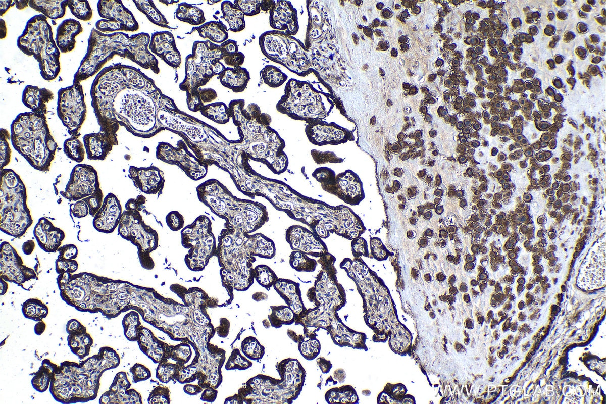 Immunohistochemistry (IHC) staining of human placenta tissue using SH3GLB2 Polyclonal antibody (15897-1-AP)